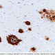 Illustration for article titled New treatment reduces a key Alzheimers Disease protein by a staggering 90 percent